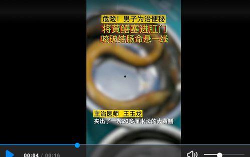 国产塞肛道具视频网站,探索隐秘角落的奇幻世界